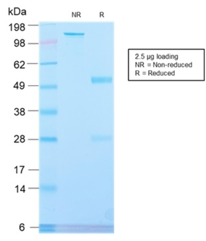 ALPP Antibody