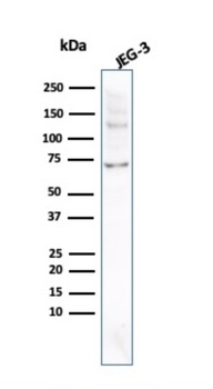 ALPP Antibody