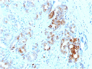 FTL Antibody