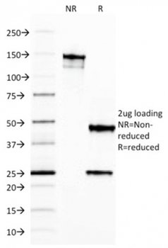 FTL Antibody