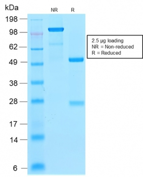 FTL Antibody