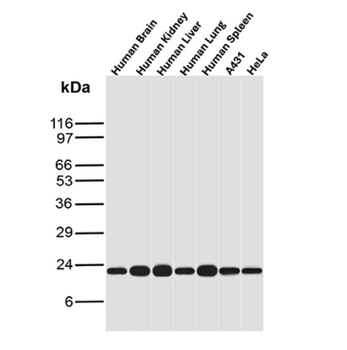 FTL Antibody