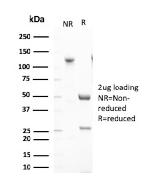 FTL Antibody