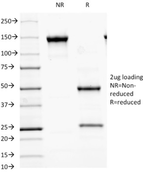 GAD2 Antibody
