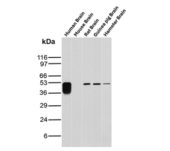GFAP Antibody