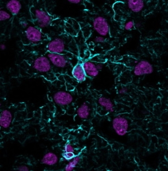 GFAP Antibody
