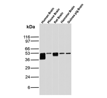 GFAP Antibody