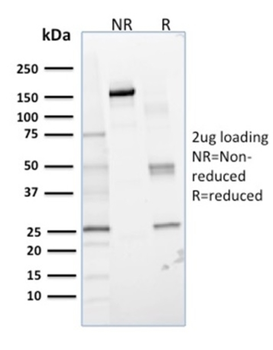 GLO1 Antibody