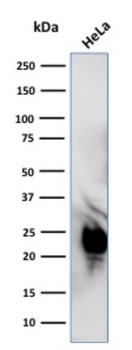 GLO1 Antibody