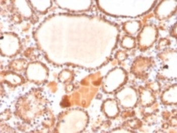 GLO1 Antibody