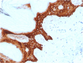 SFN Antibody