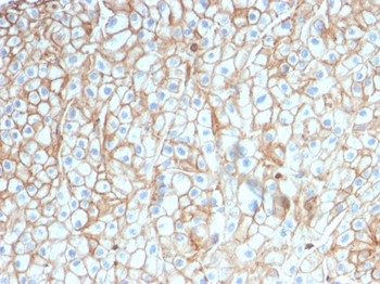 CD274 Antibody