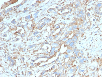 CD274 Antibody