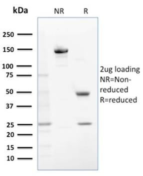 GSTM1 Antibody