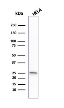 GSTM1 Antibody