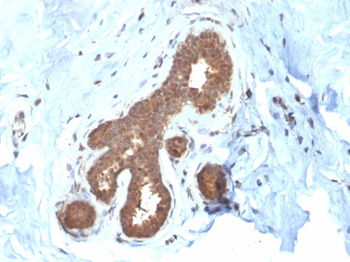 GSTM2 Antibody