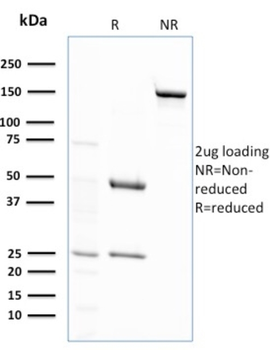 GSTM2 Antibody