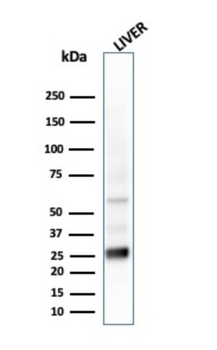 GSTM2 Antibody