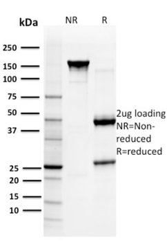 GSTM3 Antibody
