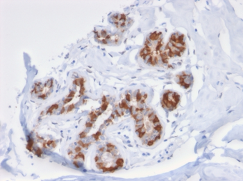 GSTM3 Antibody