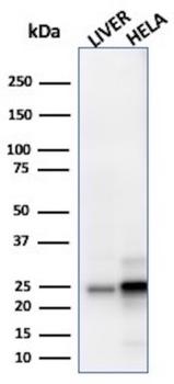 GSTM3 Antibody