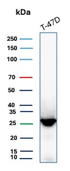 GSTM3 Antibody