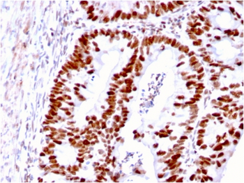 MSH6 Antibody