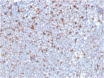MSH6 Antibody