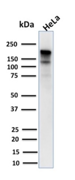 MSH6 Antibody