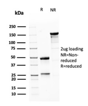 MSH6 Antibody