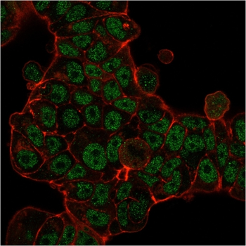 MSH6 Antibody