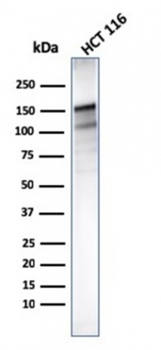 MSH6 Antibody