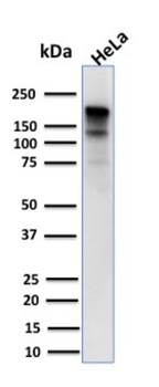MSH6 Antibody