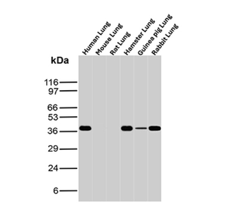 ANXA1 Antibody