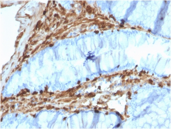 ANXA1 Antibody