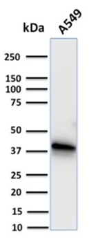 ANXA1 Antibody