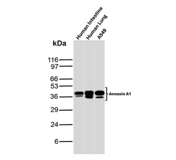 ANXA1 Antibody