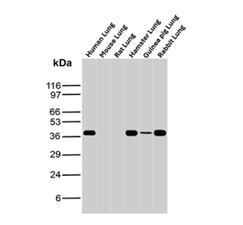 ANXA1 Antibody