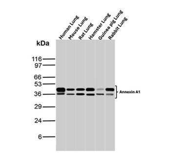 ANXA1 Antibody