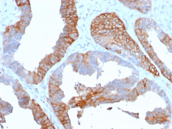 HLA-DRA Antibody