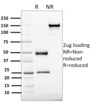 APEX1 Antibody