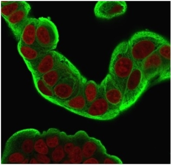 HSPB1 Antibody
