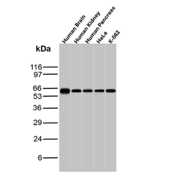 HSPD1 Antibody