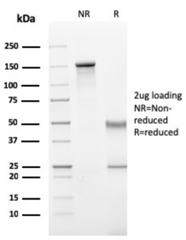 IGHG1 Antibody