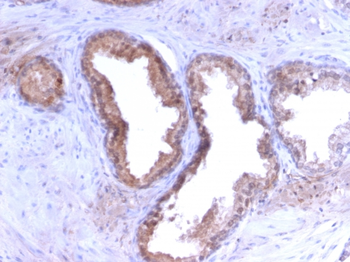 KLK3 Antibody