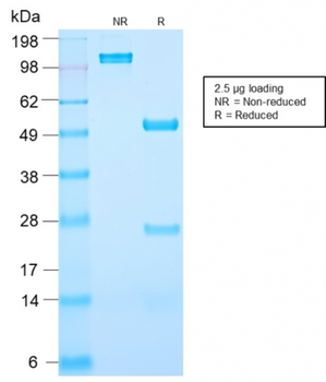 KLK3 Antibody