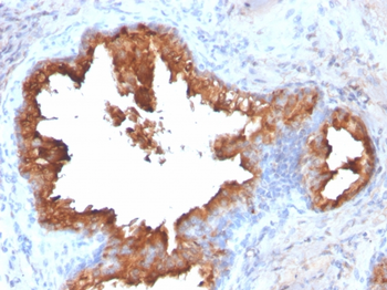 KLK3 Antibody