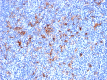 IL2RA Antibody