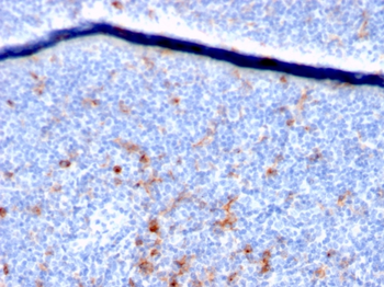 IL2RA Antibody