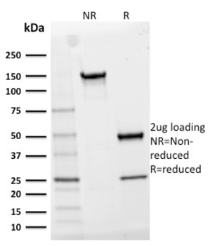 IL2RA Antibody